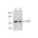 EEPD1 Antibody (B-5) - Western Blotting - Image 305645 