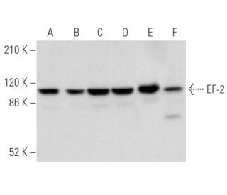 western blotting image from recommended EF-2 (C-9) monoclonal antibody replacement. Image 355849