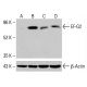 EF-G2 Antikörper (E-10): sc-514242. Western Blot Analyse der EF-G2 Expression in unbehandelten (A) und chemisch behandelten (B, C, D) HCT-116-Gesamtzelllysaten. β-Actin (C4): sc-47778 als Ladekontrolle verwendet. Verwendetes Nachweisreagenz: m-IgG Fc BP-HRP: sc-525409. EF-G2 Antibody (E-10) - Western Blotting - Image 415624