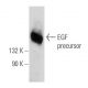 western blotting image from recommended EGF (F-9) monoclonal antibody replacement. Image 109572