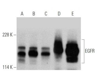 EGFR Antibody A 10 SCBT Santa Cruz Biotechnology