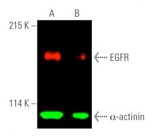 EGFR Antibody A 10 SCBT Santa Cruz Biotechnology