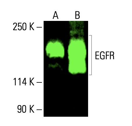 acoとなります アフリカンテキスタイルスニーカー(スニーカー) | al'aise