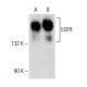 western blotting image from recommended EGFR (A-10) monoclonal antibody replacement. Image 146629