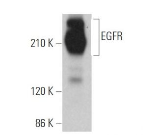 EGFR Antibody (F-9) SCBT Santa Cruz Biotechnology, 41% OFF