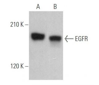 EGFR Antibody (3H2094) - Western Blotting - Image 364744 