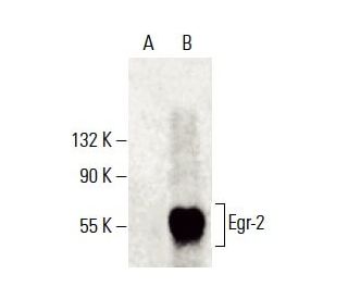 Egr-2 Antibody (G-9) - Western Blotting - Image 396356 