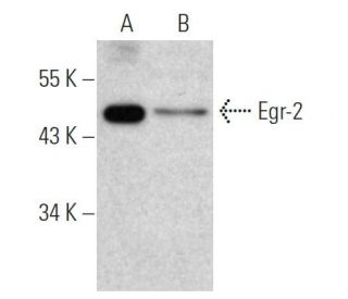 western blotting image from recommended Egr-2 (1G5) monoclonal antibody replacement. Image 368010