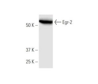 Egr-2 Antibody (1G5) - Western Blotting - Image 347552The Double Nickase Plasmid features a U6 promoter for sgRNA expression, a 20 nt targeting sequence, and a gRNA scaffold to guide Cas9n. It includes a CBh promoter for Cas9n (D10A) and puromycin resistance, GFP for transfection verification, and nuclear localization signals (NLS). The 2A peptide allows co-expression of Cas9n and Puro from a single promoter, enabling precise genome editing with reduced off-target effects. 