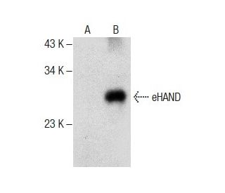 western blotting image from recommended eHAND (F-7) monoclonal antibody replacement. Image 287873
