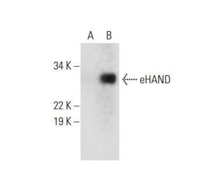 eHAND Antibody (D-1) - Western Blotting - Image 289687