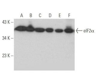 western blotting image from recommended eIF2α (D-3) monoclonal antibody replacement. Image 352797