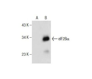 eIF2B&alpha; Antibody (C-11) - Western Blotting - Image 159785The Double Nickase Plasmid features a U6 promoter for sgRNA expression, a 20 nt targeting sequence, and a gRNA scaffold to guide Cas9n. It includes a CBh promoter for Cas9n (D10A) and puromycin resistance, GFP for transfection verification, and nuclear localization signals (NLS). The 2A peptide allows co-expression of Cas9n and Puro from a single promoter, enabling precise genome editing with reduced off-target effects. 
