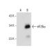 eIF2Bα Antibody (C-11) - Western Blotting - Image 159785
