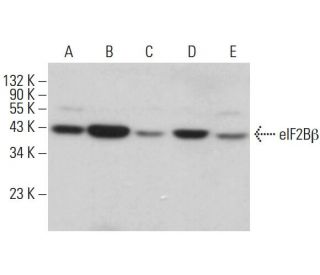 eIF2B&beta; Antibody (P-4) - Western Blotting - Image 380823 
