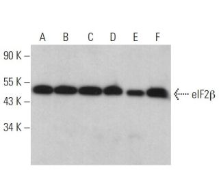 eIF2&beta; Antibody (C-9) - Western Blotting - Image 359273 