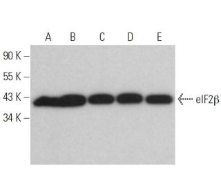 eIF2&beta; Antibody (D-3) - Western Blotting - Image 359272 
