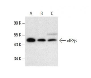 eIF2&beta; Antibody (E-4) - Western Blotting - Image 296900 