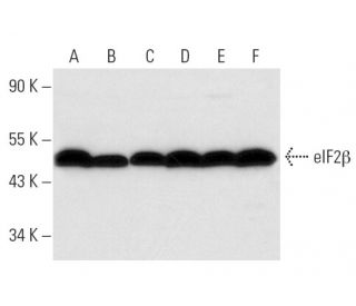 eIF2&beta; Antibody (P-3) - Western Blotting - Image 11581 