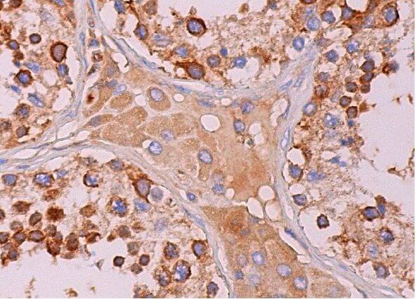 eIF3η Antibody (C-5) | SCBT - Santa Cruz Biotechnology