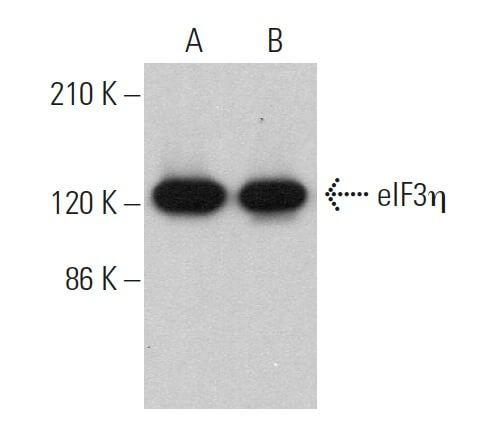 timtum様 eIF3η Antibody (C-5) | SCBT - Santa Cruz Biotechnology
