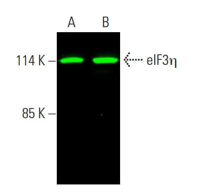 Take.Free&Out様 eif3eta-antibody-c-5-western-