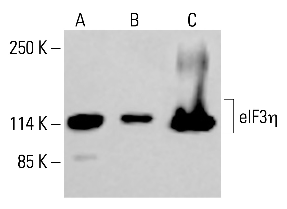 Take.Free&Out様 eif3eta-antibody-c-5-western-