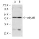 eIF4AIII Antibody (3F1) - Western Blotting - Image 12578