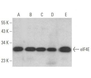 western blotting image from recommended eIF4E (P-2) monoclonal antibody replacement. Image 352429