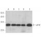 western blotting image from recommended eIF4E (P-2) monoclonal antibody replacement. Image 352429