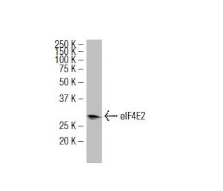eIF4E2 Antibody (YB-18) - Western Blotting - Image 34104The Double Nickase Plasmid features a U6 promoter for sgRNA expression, a 20 nt targeting sequence, and a gRNA scaffold to guide Cas9n. It includes a CBh promoter for Cas9n (D10A) and puromycin resistance, GFP for transfection verification, and nuclear localization signals (NLS). The 2A peptide allows co-expression of Cas9n and Puro from a single promoter, enabling precise genome editing with reduced off-target effects.