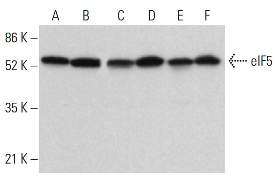 eIF5 Antibody (E-10) | SCBT - Santa Cruz Biotechnology