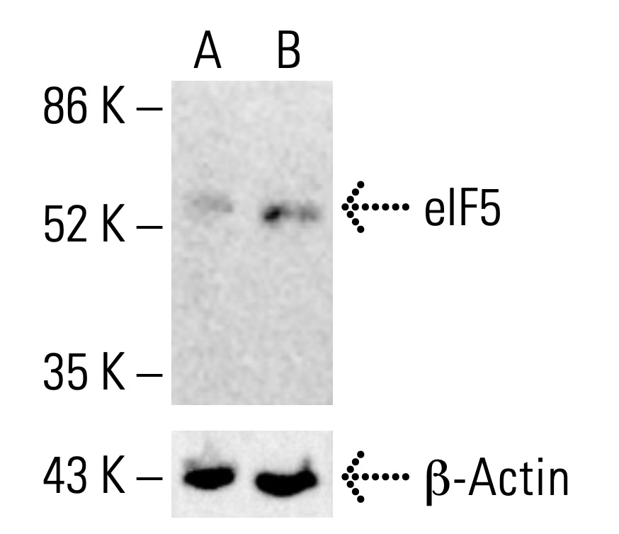 eIF5 Antibody (E-10) | SCBT - Santa Cruz Biotechnology