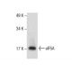 eIF5A Antibody (C-1) - Western Blotting - Image 285875 