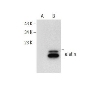 elafin Antibody (H-2) - Western Blotting - Image 300577Each CRISPR/Cas9 Knockout (KO) Plasmid product consists of a pool of 3 plasmids designed to ensure identification and cleavage of a specific gene for maximum knockout efficiency. Each plasmid encodes a unique 20 nt sequence derived from the GeCKO (v2) library.