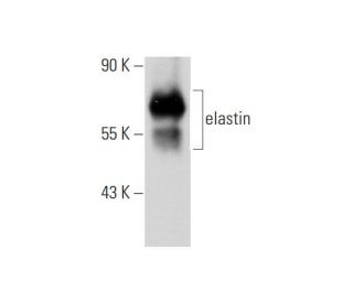 western blotting image from recommended elastin (BA-4) monoclonal antibody replacement. Image 129605