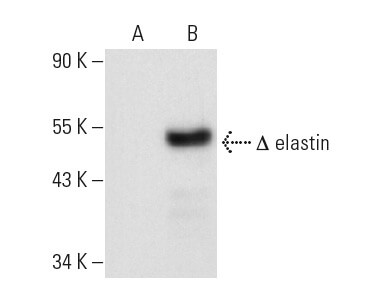elastin Antibody (B-10) | SCBT - Santa Cruz Biotechnology