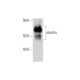 This polyclonal antibody has been discontinued. See our recommended <a href="elastin-antibody-ba-4">elastin (BA-4)</a> monoclonal antibody (sample data shown). western blotting image from recommended elastin (BA-4) monoclonal antibody replacement. Image 129605