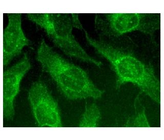 immunofluorescence image from recommended Elf-5 (C-1) monoclonal antibody replacement. Image 159665
