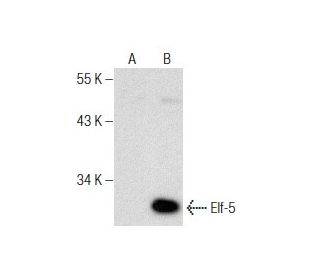 Elf-5 Antibody (C-1) - Western Blotting - Image 158447The Double Nickase Plasmid features a U6 promoter for sgRNA expression, a 20 nt targeting sequence, and a gRNA scaffold to guide Cas9n. It includes a CBh promoter for Cas9n (D10A) and puromycin resistance, GFP for transfection verification, and nuclear localization signals (NLS). The 2A peptide allows co-expression of Cas9n and Puro from a single promoter, enabling precise genome editing with reduced off-target effects.
