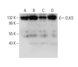 ELKS Antibody (E-1): sc-365715