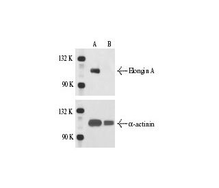 Elongin A siRNA (h): sc-35292. Western blot analysis of Elongin A expression in non-transfected control (A) and Elongin A 