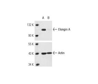 Elongin A siRNA (m): sc-sc-35293. Western blot analysis of Elongin A expression in non-transfected control (A) and Elongin 