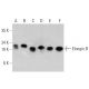 western blotting image from recommended Elongin B (D-5) monoclonal antibody replacement. Image 358572