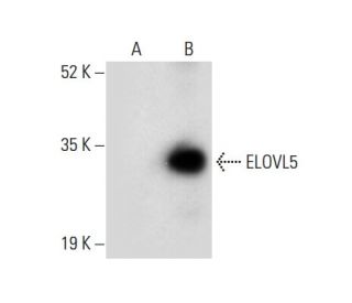 ELOVL5 Antibody (E-10) - Western Blotting - Image 308013