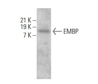EMBP Antibody (F-6) - Western Blotting - Image 385297Each CRISPR/Cas9 Knockout (KO) Plasmid product consists of a pool of 3 plasmids designed to ensure identification and cleavage of a specific gene for maximum knockout efficiency. Each plasmid encodes a unique 20 nt sequence derived from the GeCKO (v2) library.