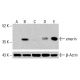 Anticorps emerin (F-11): sc-398278. Analyse par Western blot de l'expression de l'emerin dans des lysats cellulaires complets non traités de K-562 (A), traités chimiquement de K-562 (B), non traités de HCT-116 (C), traités chimiquement de HCT-116 (D) et de HeLa (E). β-Actine (C4): sc-47778 utilisé comme contrôle de chargement. Réactif de détection utilisé: m-IgG Fc BP-HRP: sc-525409. emerin Antibody (F-11) - Western Blotting - Image 415393