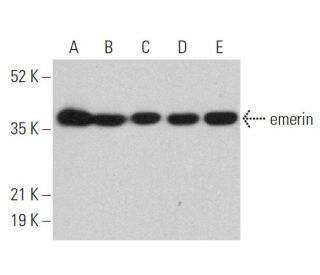emerin Antibody (H-12) - Western Blotting - Image 359734 