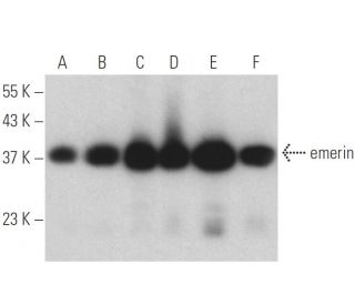 emerin Antibody (H-12) - Western Blotting - Image 399077 