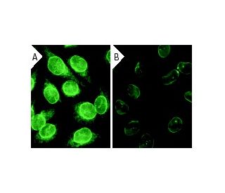 emerin siRNA (h): sc-35296. Immunofluorescence staining of methanol-fixed, control HeLa (A) and emerin siRNA silenced HeLa 